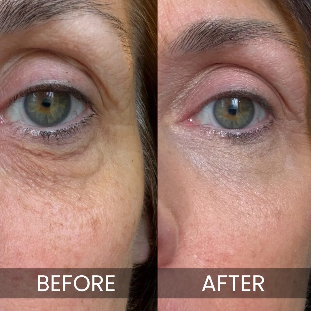Luxe - Korean Under-Eye Balm, photograph 4