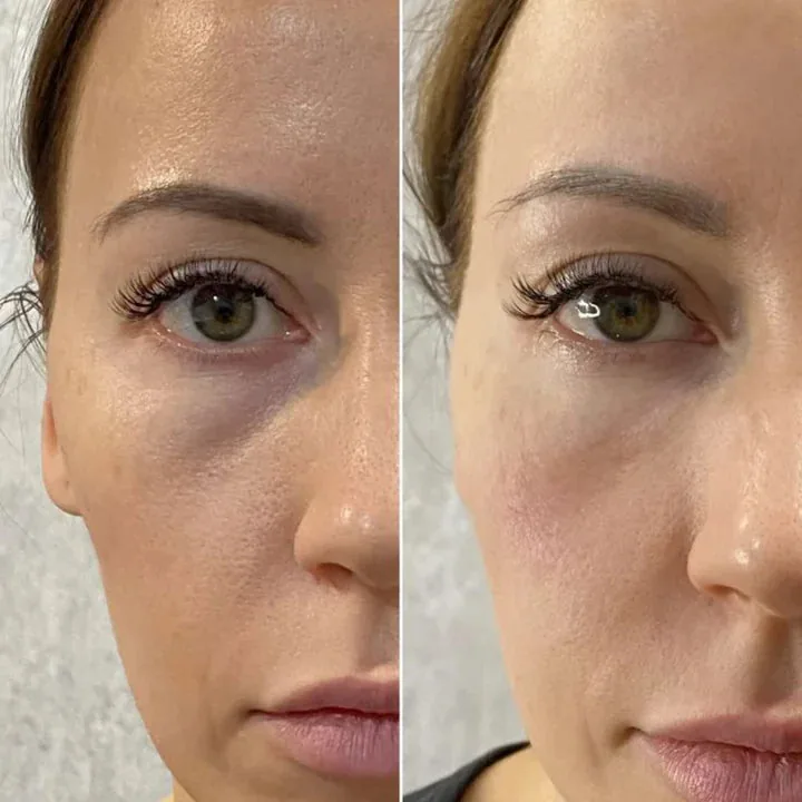 Susan L, 47