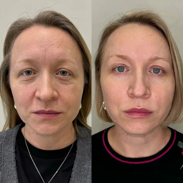 Carol A, 63
